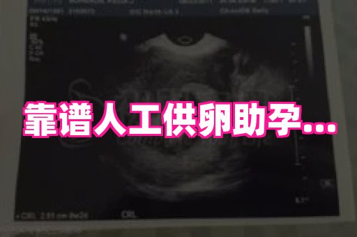 长春助孕网 4